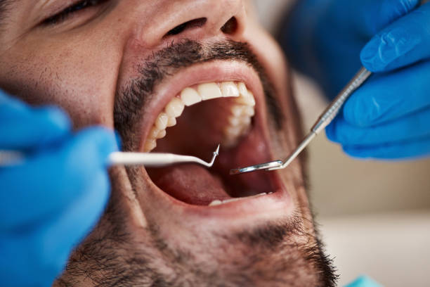 Best Emergency Broken Tooth Repair in Campbellsport, WI
