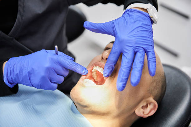 Best Emergency Root Canal Treatment in Campbellsport, WI